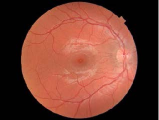 Your Eyes - Spectacle Makers Lecture Event St Thomas' Hospital